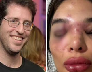 Dentista conta como sofria agress�es e amea�as do marido, que est� preso