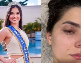 Homem � culpado por bater em antiga rainha de beleza do Acre por ci�mes